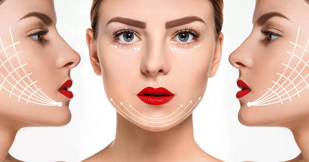 botox in masseter