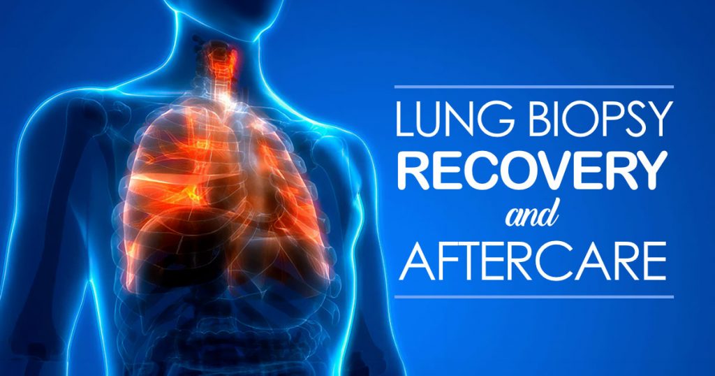 lung biopsy recovery