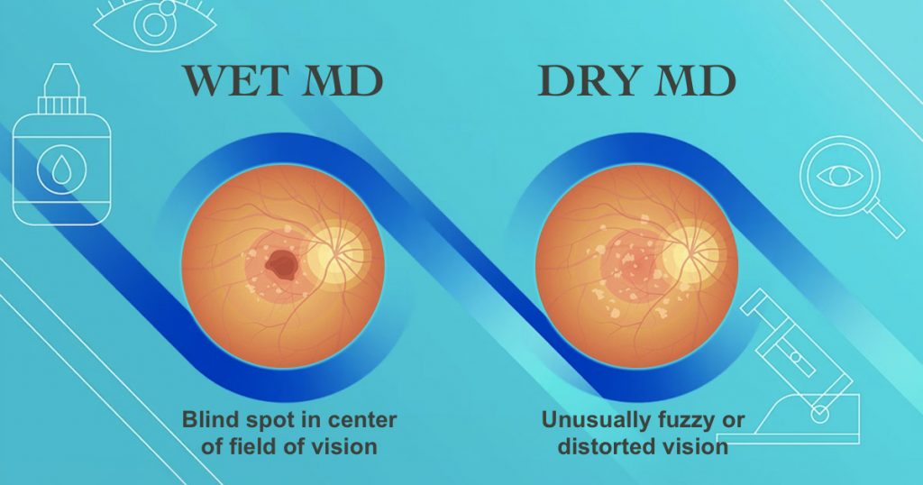 difference between wet and dry macular degeneration