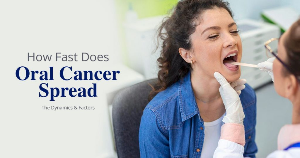 how-fast-oral-cancer-spread