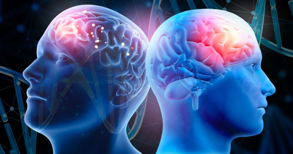 stroke vs brain aneurysm
