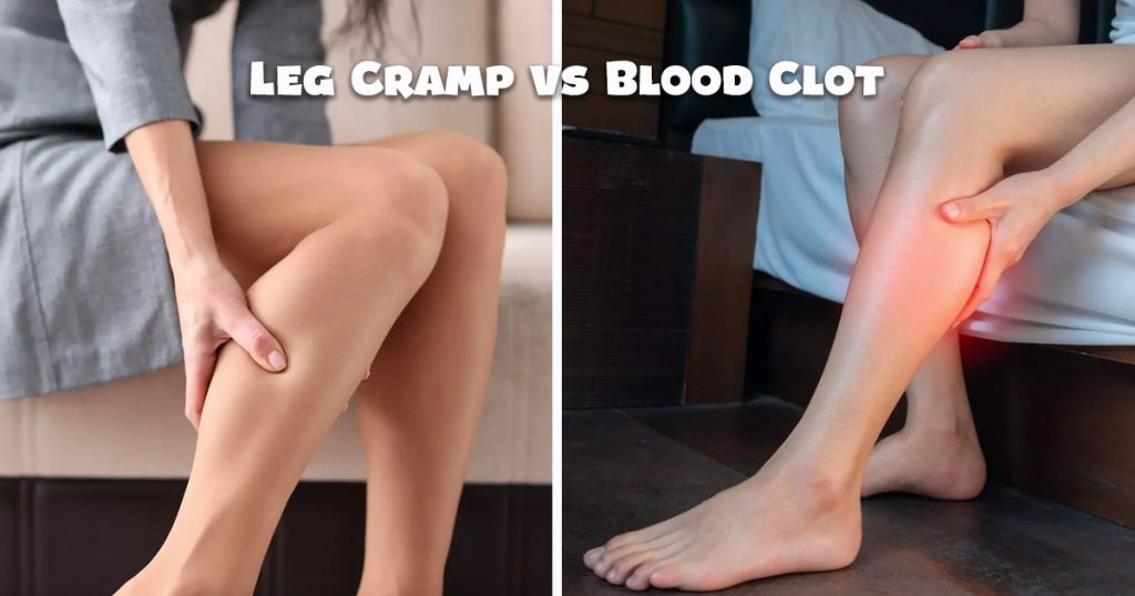 leg cramp vs blood clot
