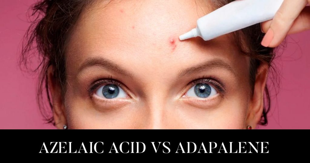 azelaic-acid-vs-adapalene