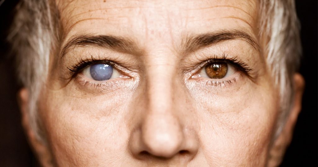 pros and cons of cataract surgery