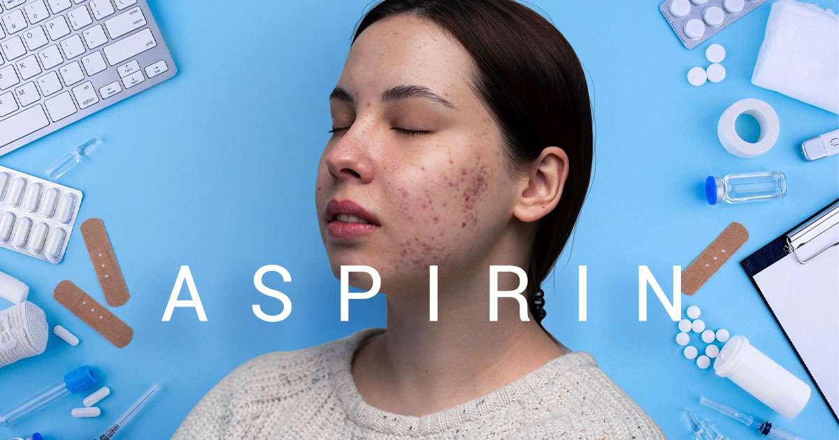 aspirin for acne