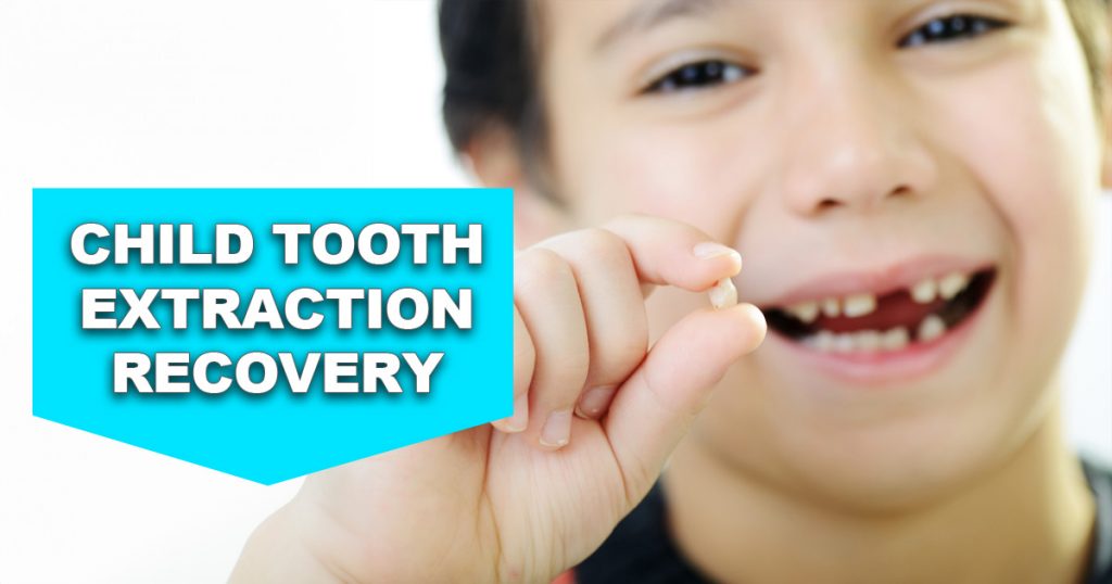 child-tooth-extraction-recovery