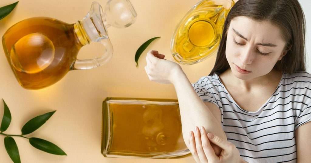 does tea tree oil help with keloids