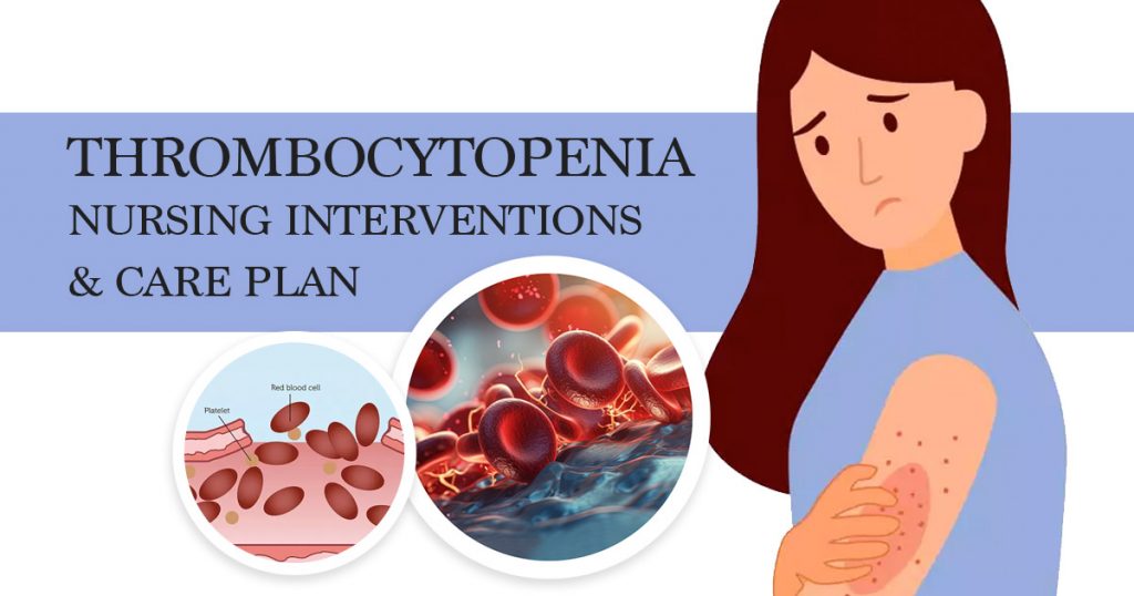 thrombocytopenia-nursing-interventions