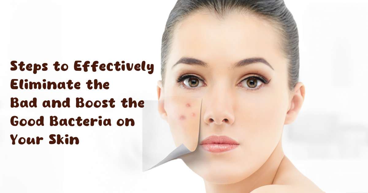 how to get rid of bacteria on face