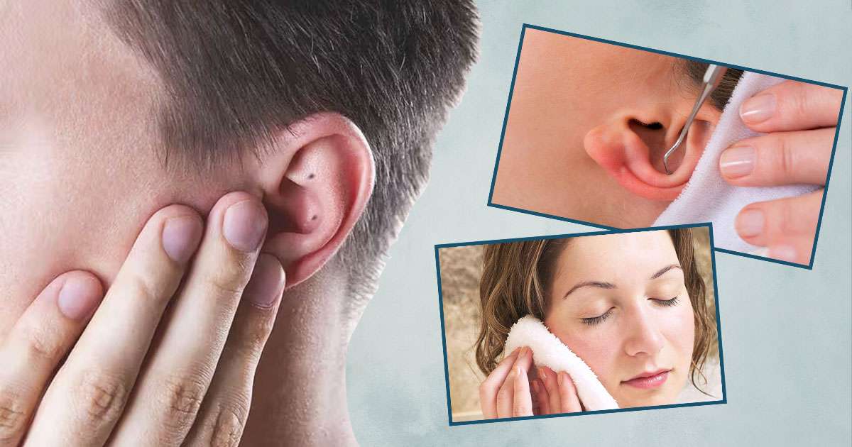 prevent blackheads in ears