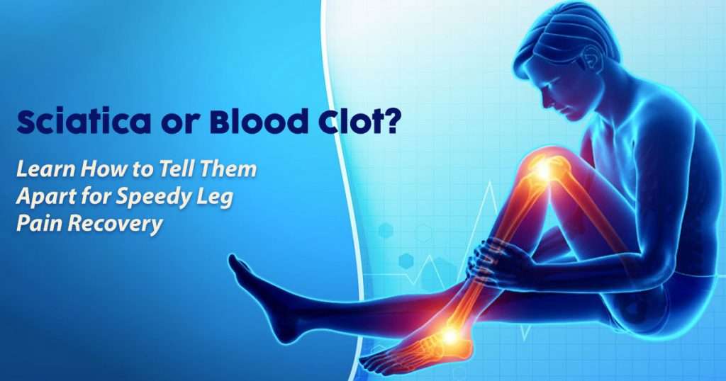 sciatica or blood clot