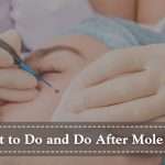 mole removal aftercare