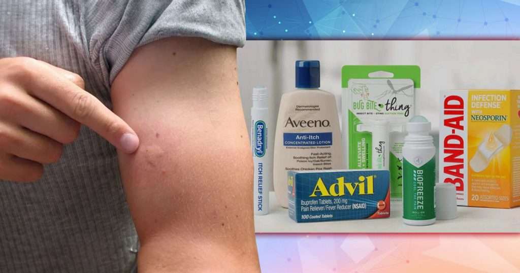 how to get rid of bug bite scars
