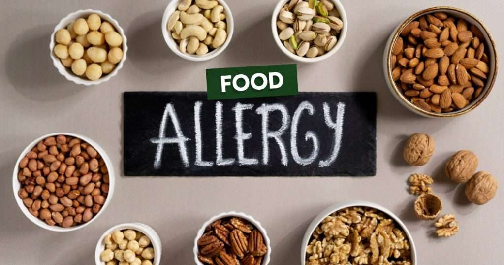 food-allergies-and-intolerances