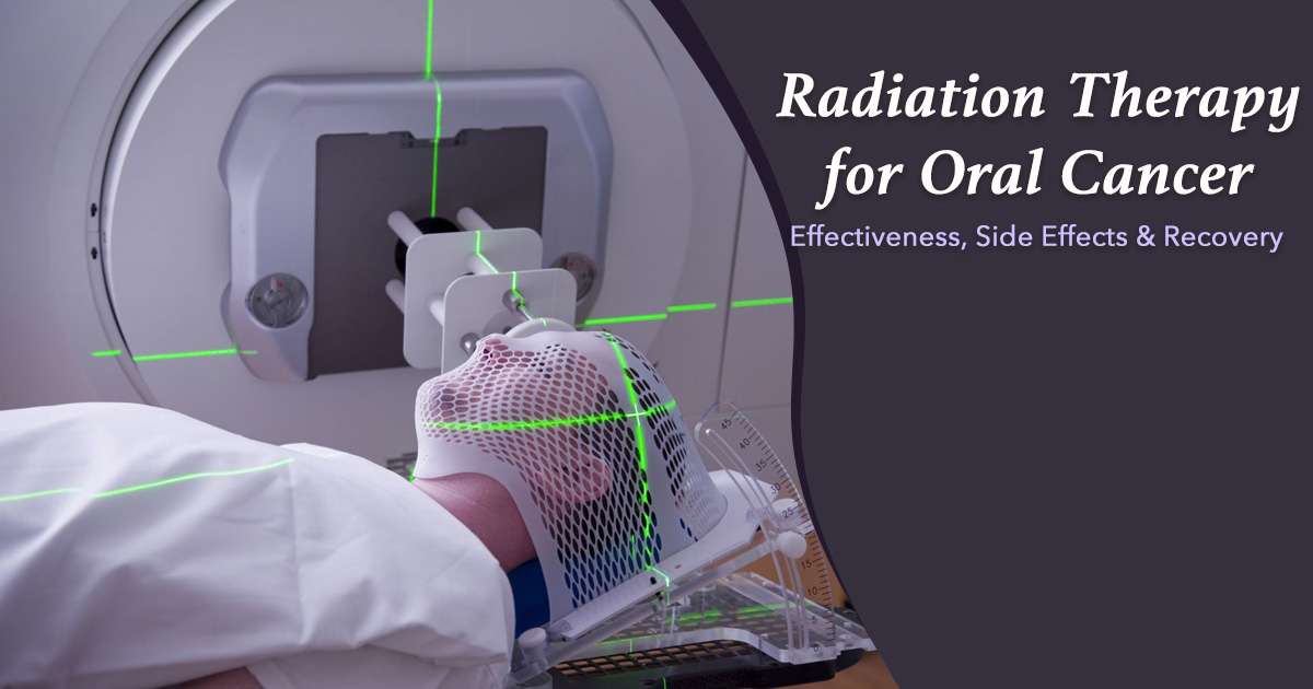 radiation for oral cancer