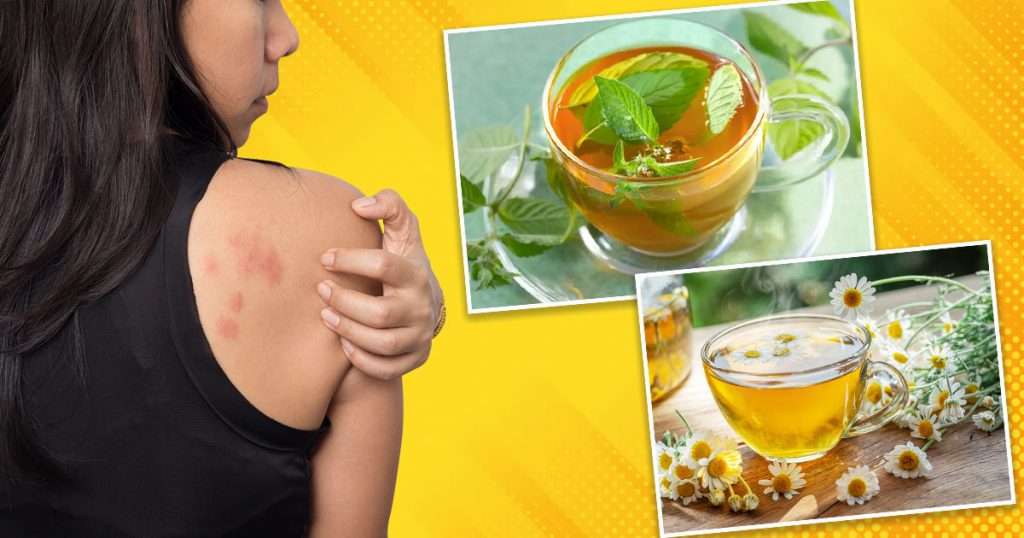 what tea is good for skin rash