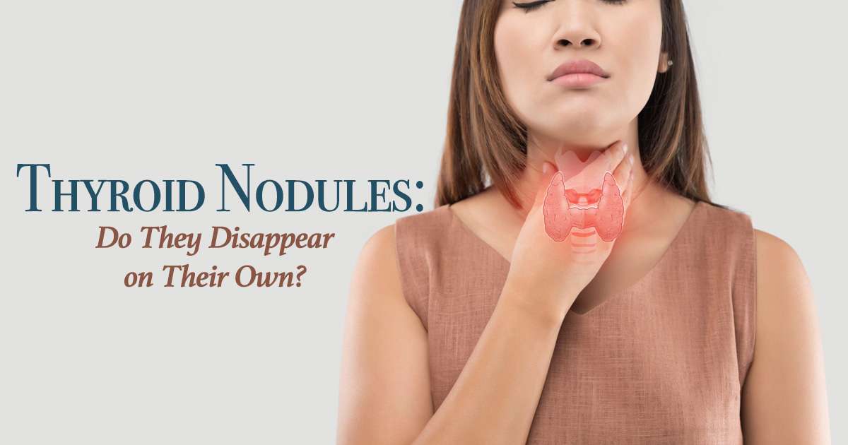 can-thyroid-nodules-disappear