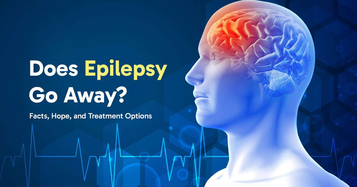 can you outgrow epilepsy