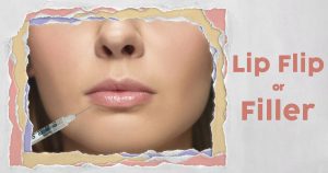 lip-flip-or-filler