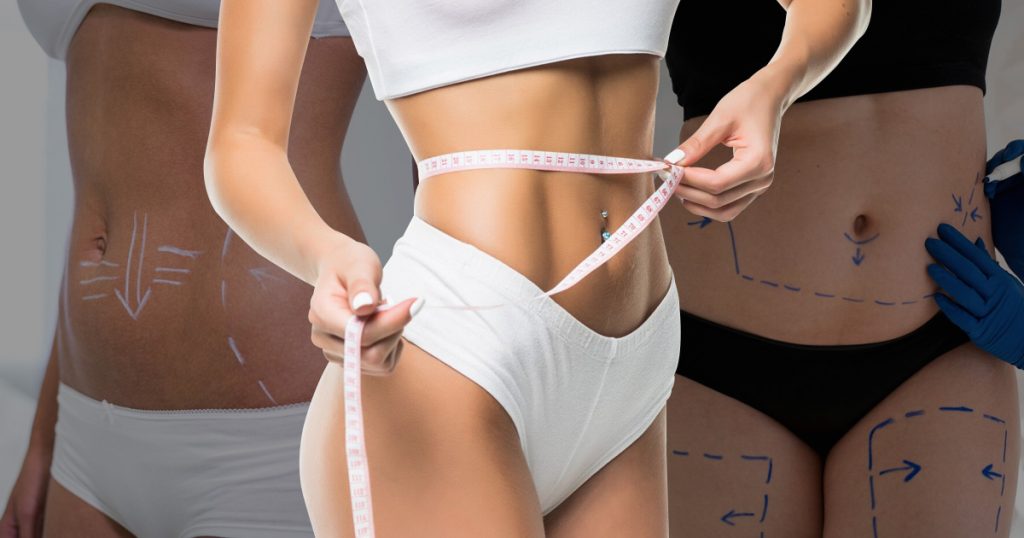 liposuction-vs-coolsculpting