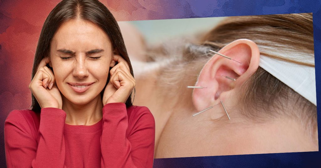 can acupuncture help tinnitus
