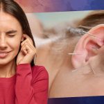 can acupuncture help tinnitus