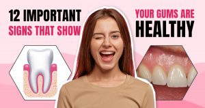 What do healthy gums look like