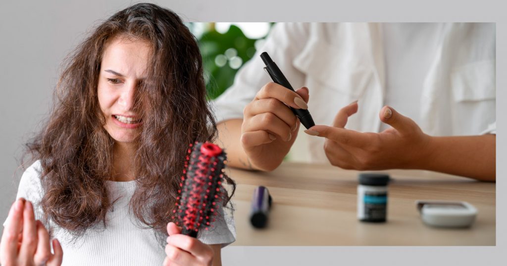 diabetes-and-hair-loss
