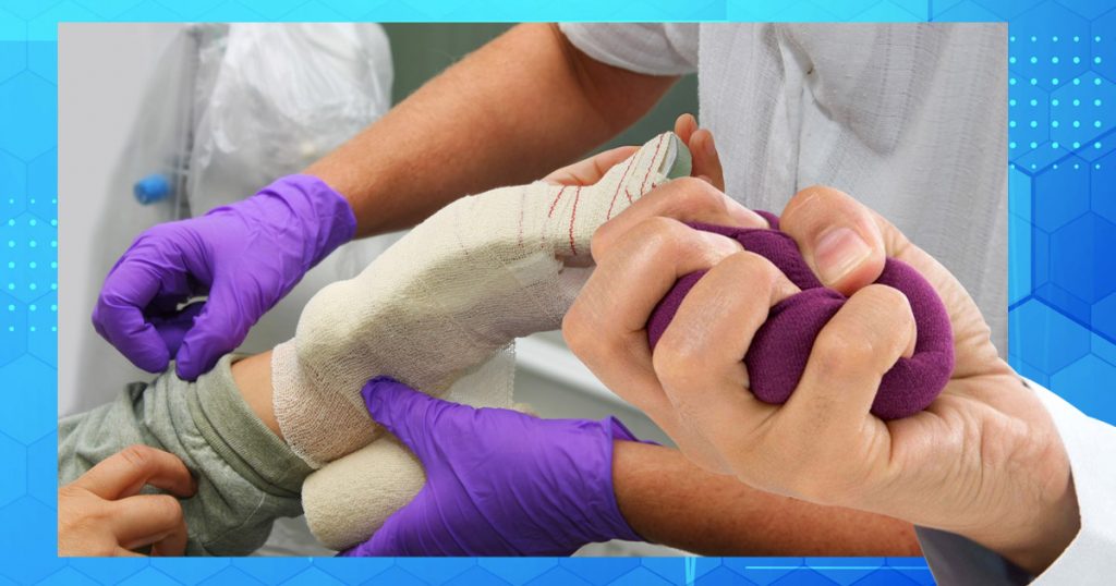 recovery tips from carpal tunnel surgery