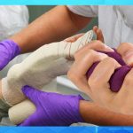 recovery tips from carpal tunnel surgery