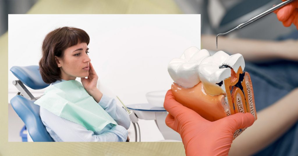 Root canal vs filling