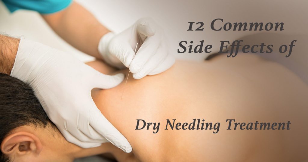 dry-needling-side-effects