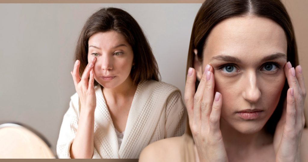 eye-bags-get-rid-of-them