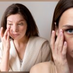 eye-bags-get-rid-of-them