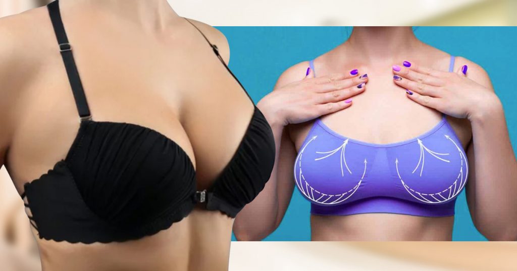 How long does breast fat transfer last